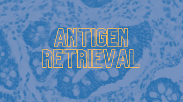 Unmasking the Hidden: Optimizing Antigen Retrieval for Immunohistochemistry and Molecular Biology