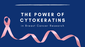 Unveiling the Hidden Secrets of Breast Cancer: The Power of Cytokeratins