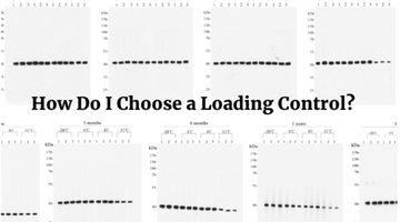 How to Choose a Loading Control for Western Blotting